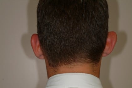 8858 Before Image