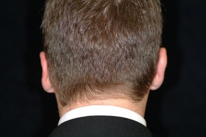 8858 After Image
