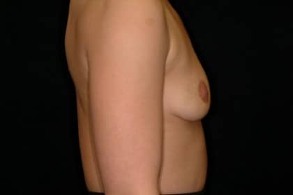 8428 Before Image