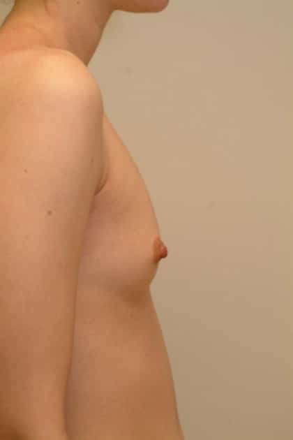 8379 Before Image