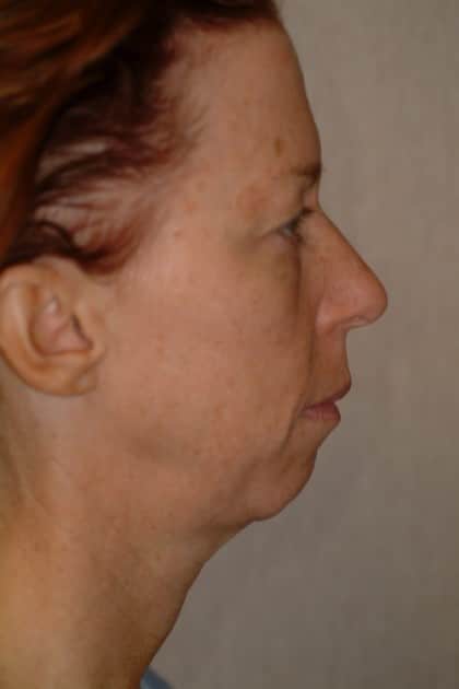 6475 Before Image