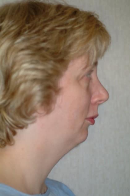 6470 Before Image