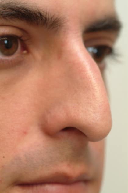 6689 Before Image
