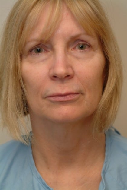 7101-30 Before Image