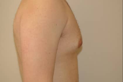 6776 Before Image