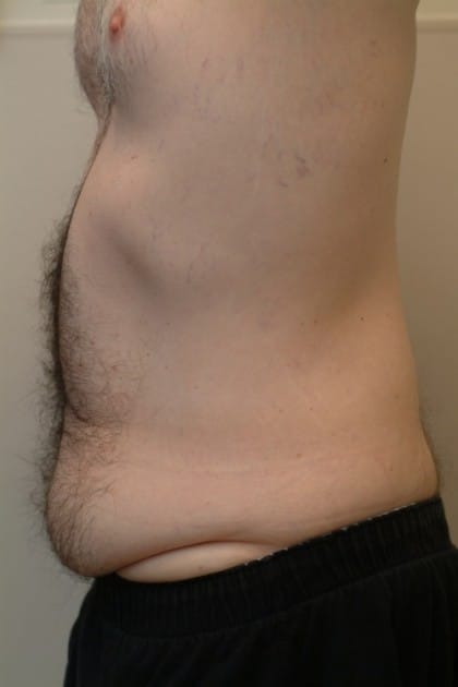7965 Before Image