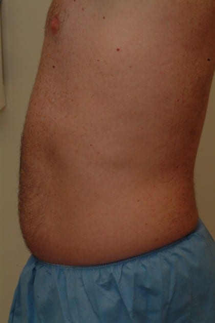 7927 Before Image