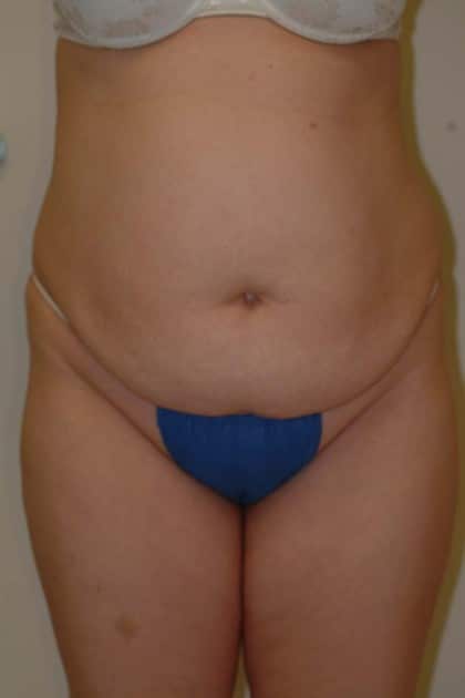 8325 Before Image