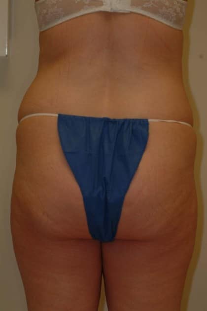 8325 Before Image