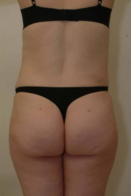 8325 After Image