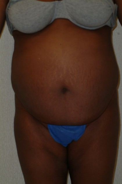 8259 Before Image