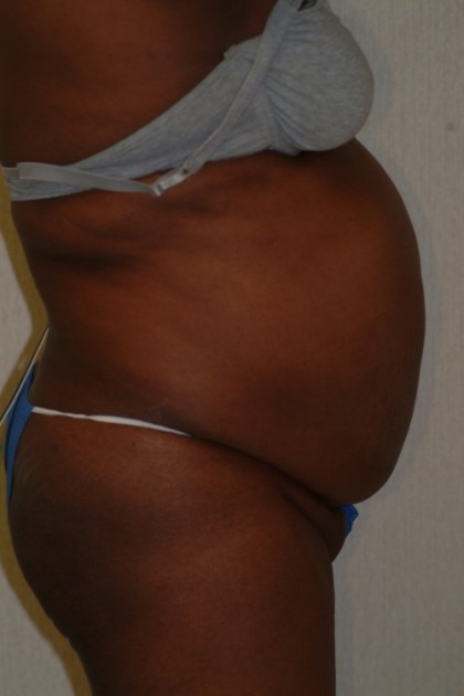 8259 Before Image