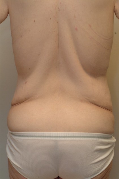 8208 Before Image