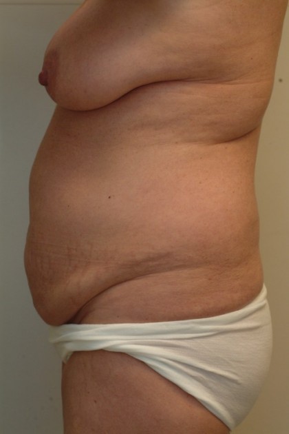 8195 Before Image