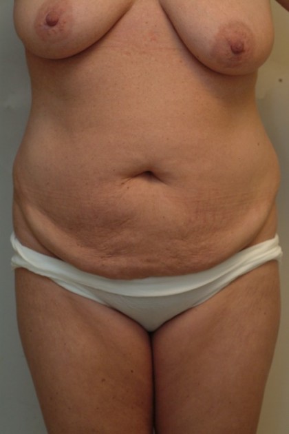 8195 Before Image