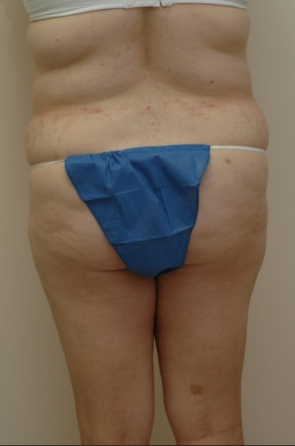 6987 Before Image
