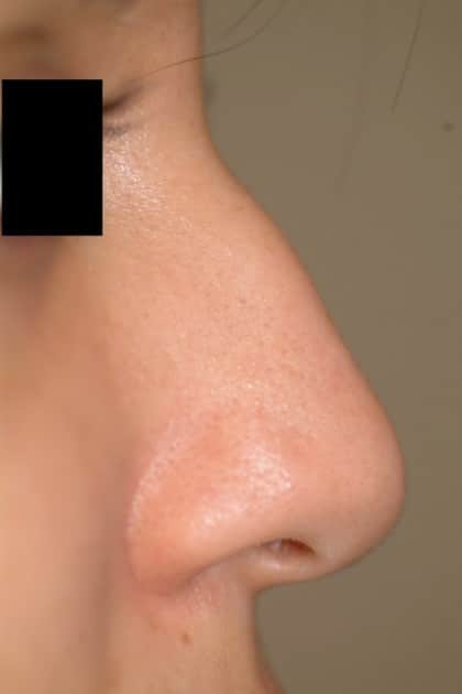 6655 Before Image