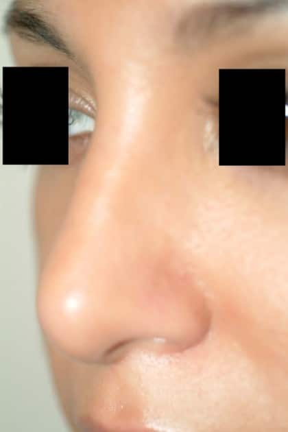 6655 After Image