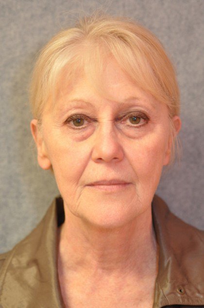 7059-10 Before Image