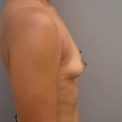11694 Before Image
