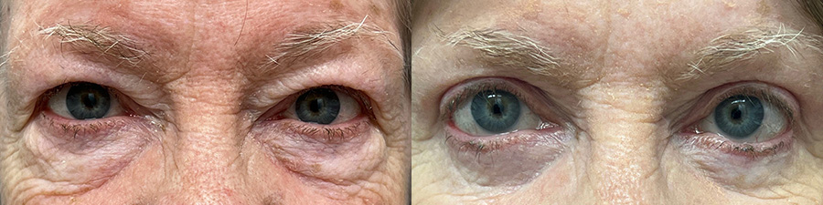 2499 Marge Image