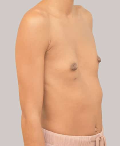 23911 – Draft 4/5 Before Image