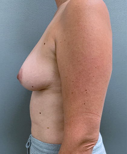 2697 – Draft 4/5 Before Image