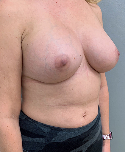 2697 – Draft 4/5 After Image