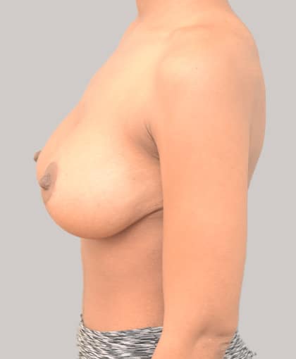 28 After Image