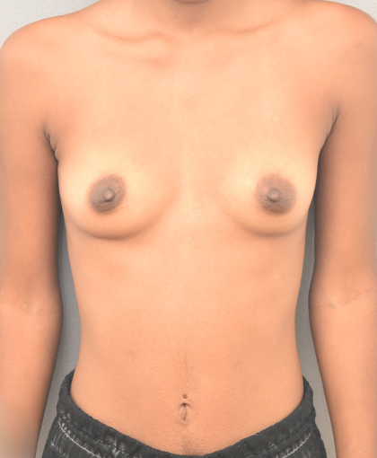 7030 Before Image