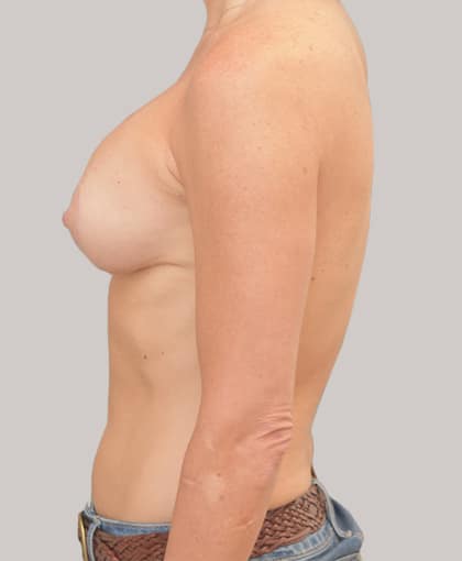 45404 After Image