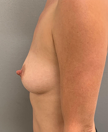 89855 Before Image