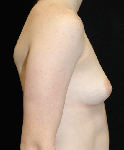 49274 Before Image