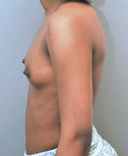 6789 – Draft 4/5 Before Image