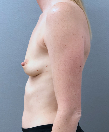 6297 Before Image