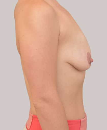 9015 Before Image