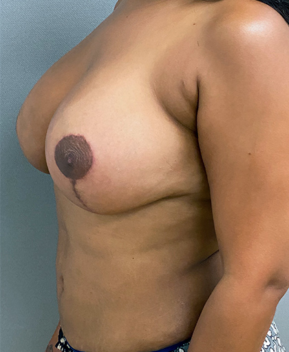 9956 After Image