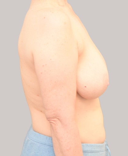 6803 Before Image