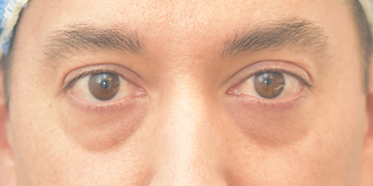8012 Before Image