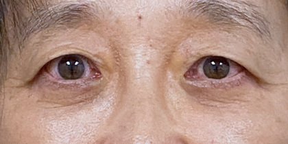 1198 After Image