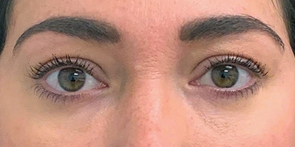 80077 After Image