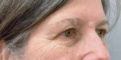 99788 Before Image