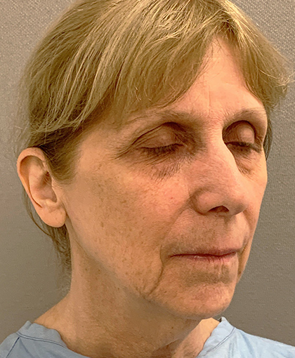 9876-10 Before Image