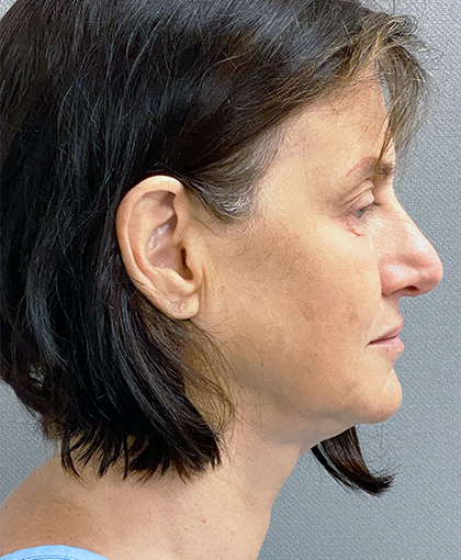 6370-20 Before Image