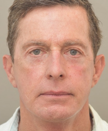 2007-20 After Image