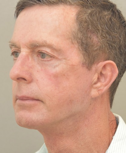 2007-20 After Image