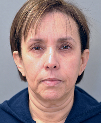 9039-10 Before Image