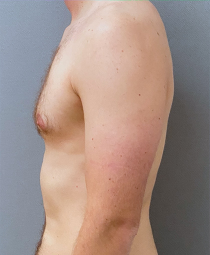 9997 Before Image