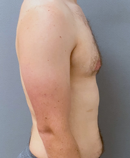 9997 Before Image