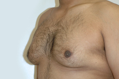 2331 Before Image
